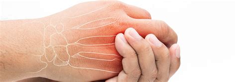 Причины и лечение боли в суставах кистей рук